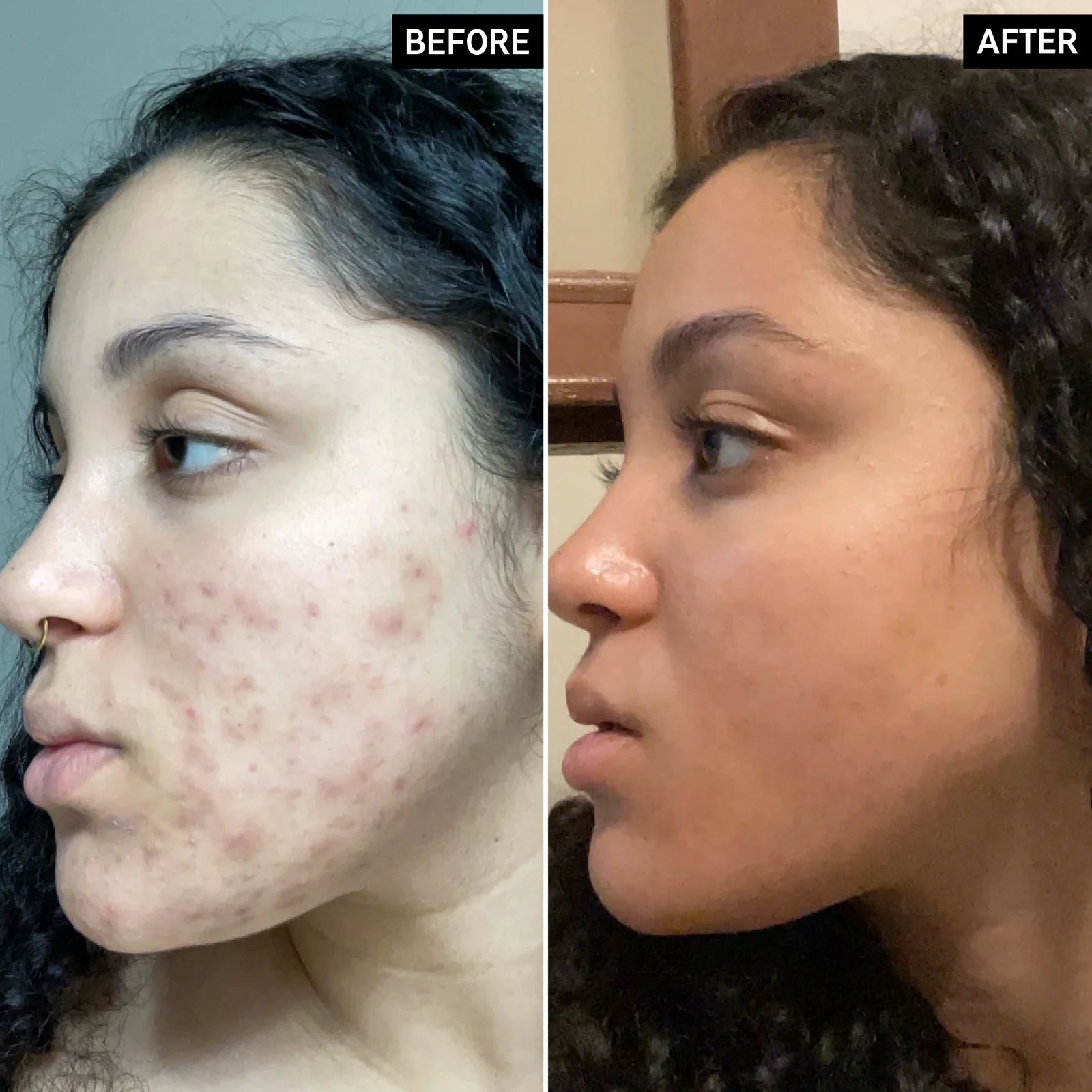 The Inkey LIST - Vitamin C Serum